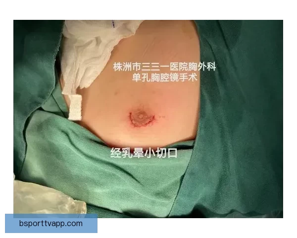 坎宁安气胸康复持续推进 活塞计划一周后复查评估